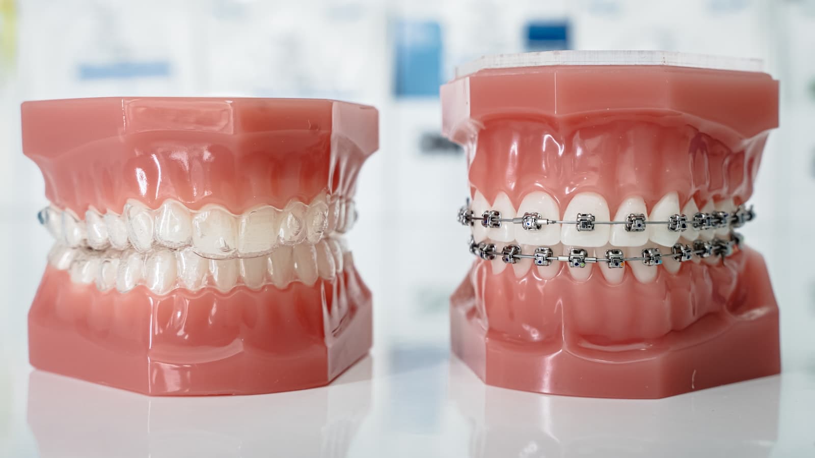 Two dental models side by side showing clear aligners and traditional metal braces on teeth, no faces or readable text.