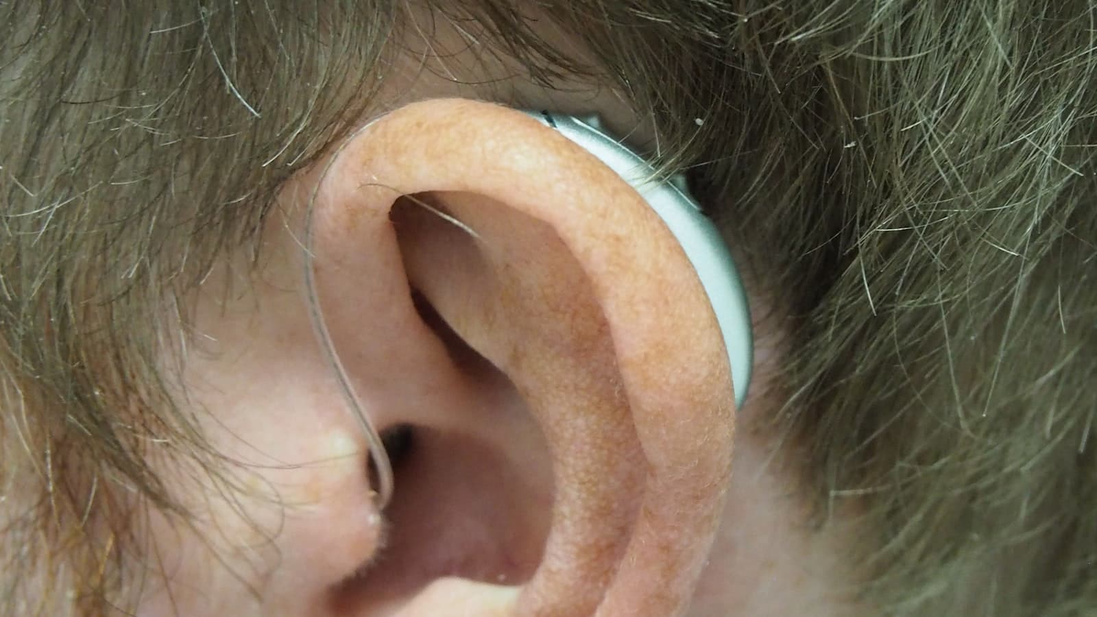 Close-up of a person's ear with a behind-the-ear hearing aid device clearly visible, no identifiable face, text, or logos.