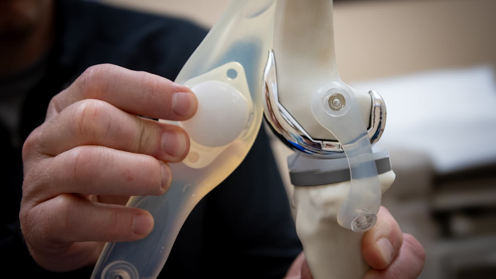A doctor examining a knee-joint replacement model in a clinic setting.