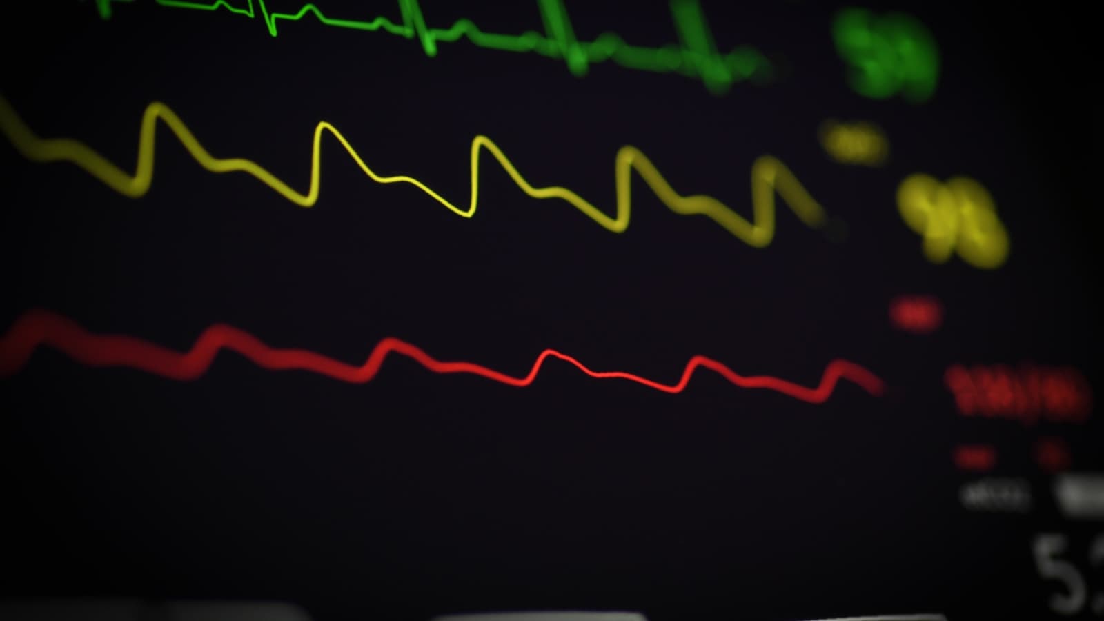 Close-up of glowing ECG waveform lines on a monitor.