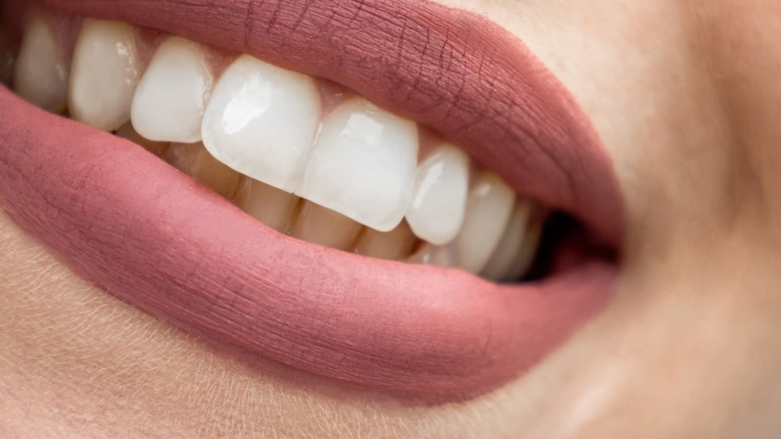 An extreme close-up of a woman's mouth showing bright white teeth.