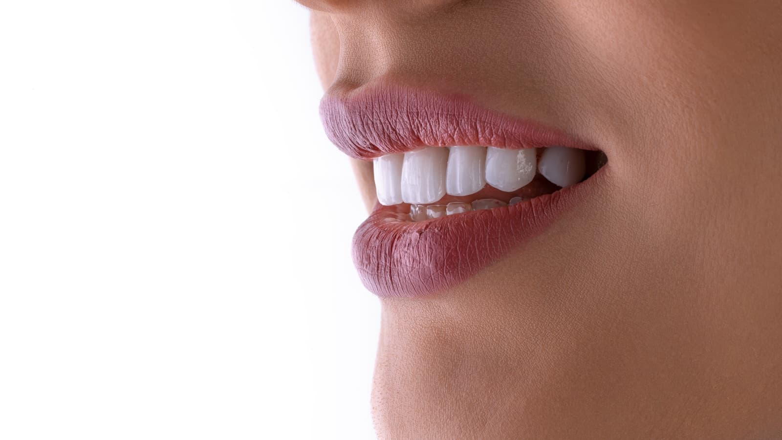 Close-up profile of a smiling mouth showing bright white, straight teeth.
